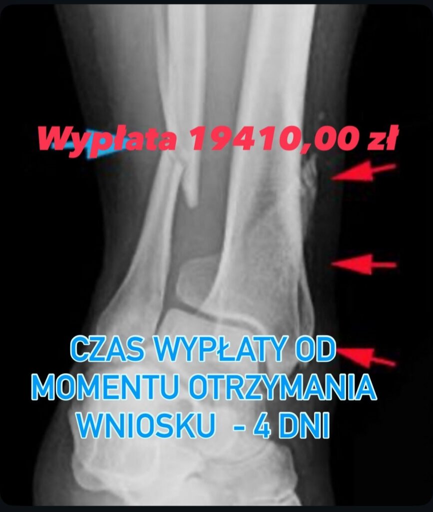 ile czekam na pieniądze z polisy?